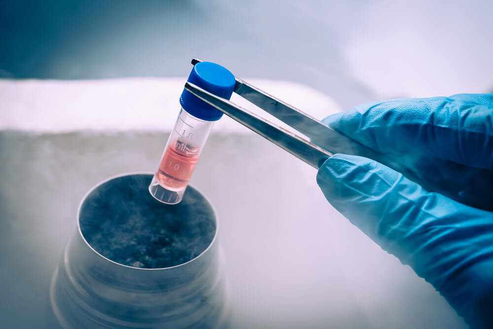 Stem cell