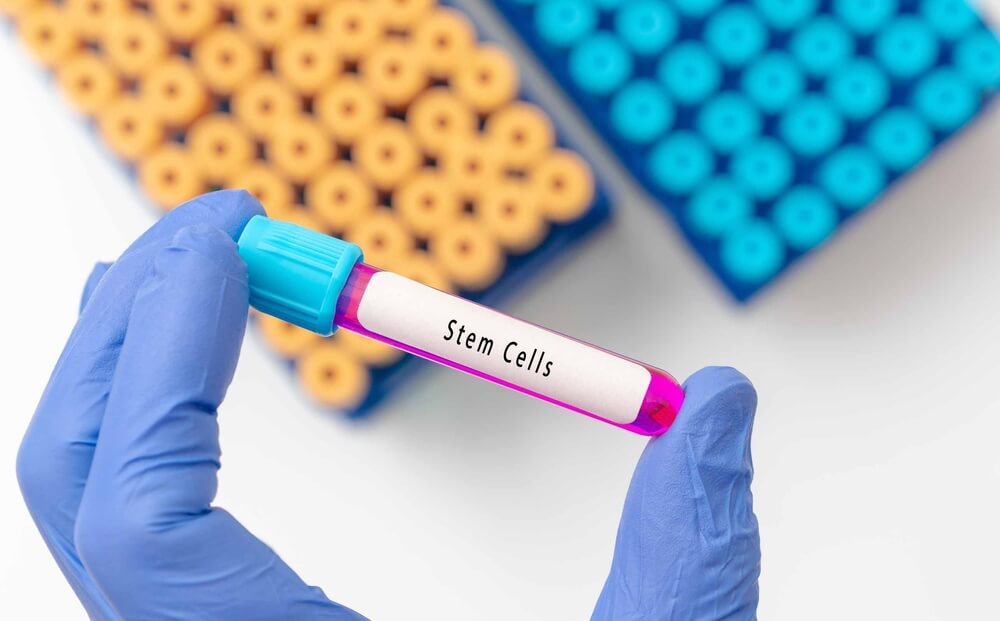 stem cell banking